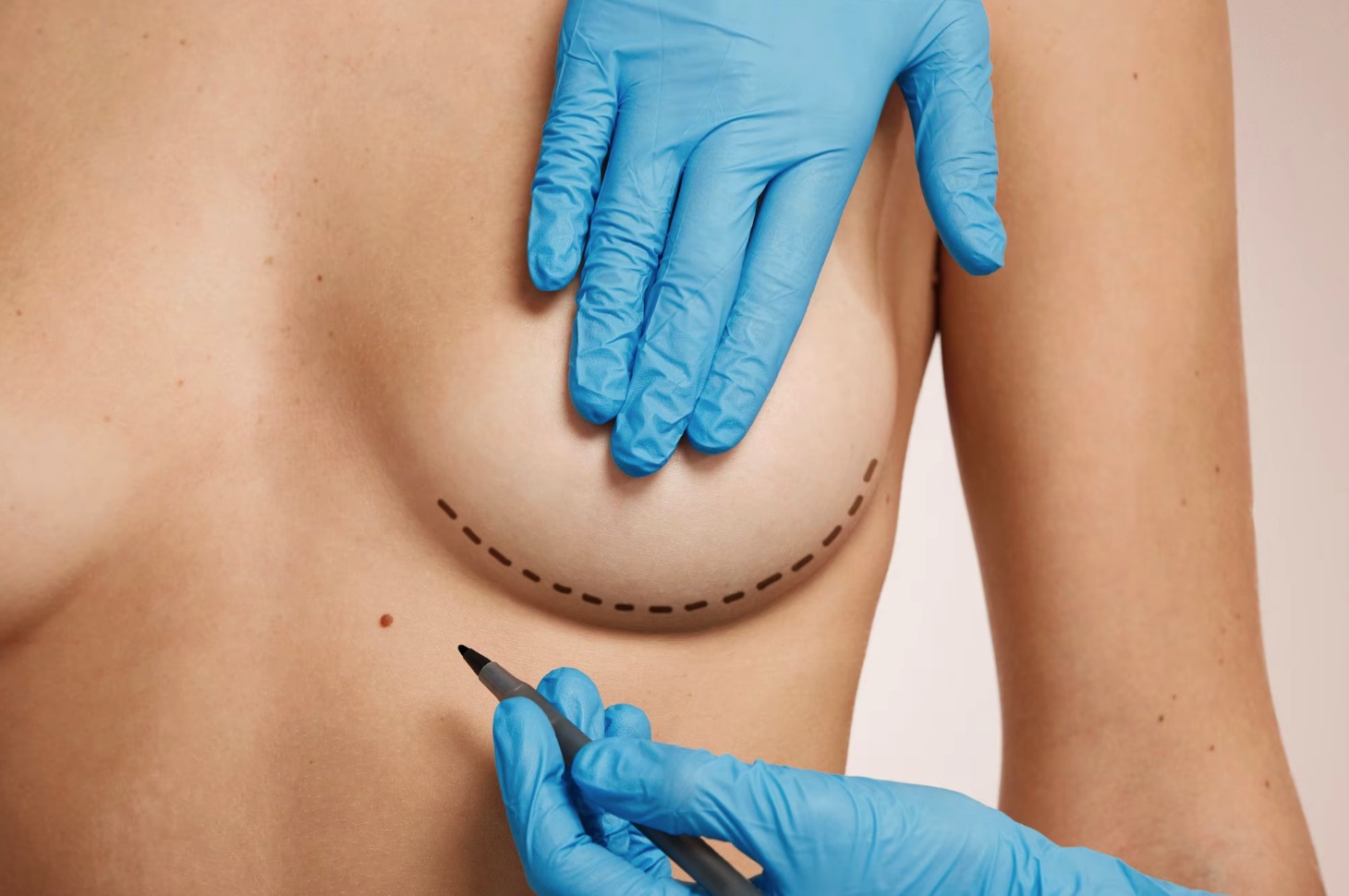 Why Dubai Is Becoming a Top Destination for Breast Lift Surgery